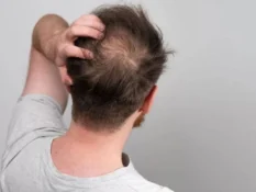 Evitar a Queda de Cabelo Apenas Mudando a Alimentação